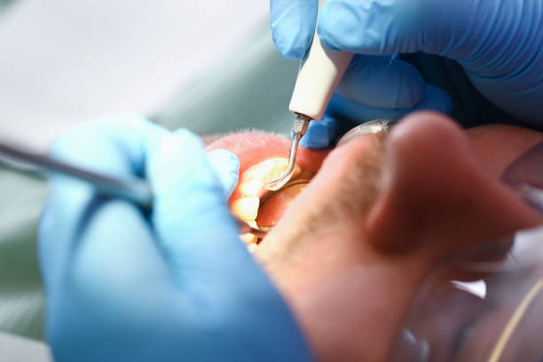Best Emergency Treatment for Dental Infections or Abscesses in Lumberton, NC
