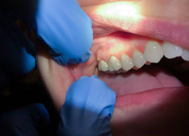Best Cosmetic Emergency Dentistry in Lumberton, NC
