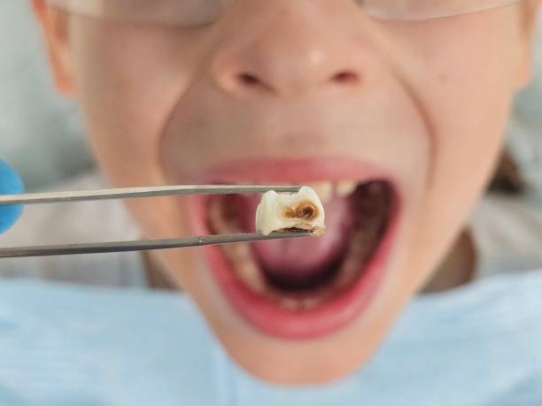 Best Emergency Dental Care for Broken or Chipped Teeth in Lumberton, NC