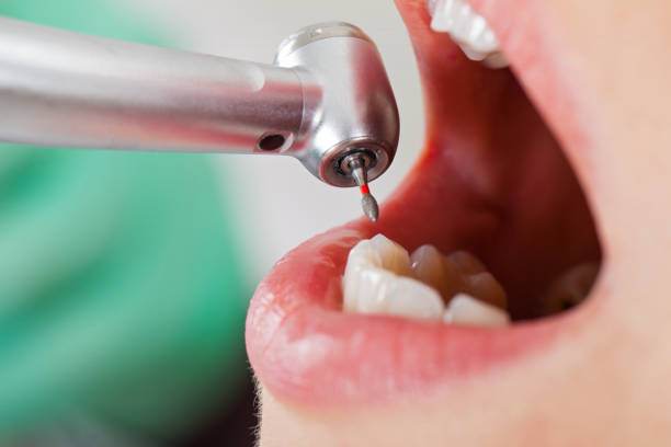 Best Pediatric Emergency Dentist in Lumberton, NC